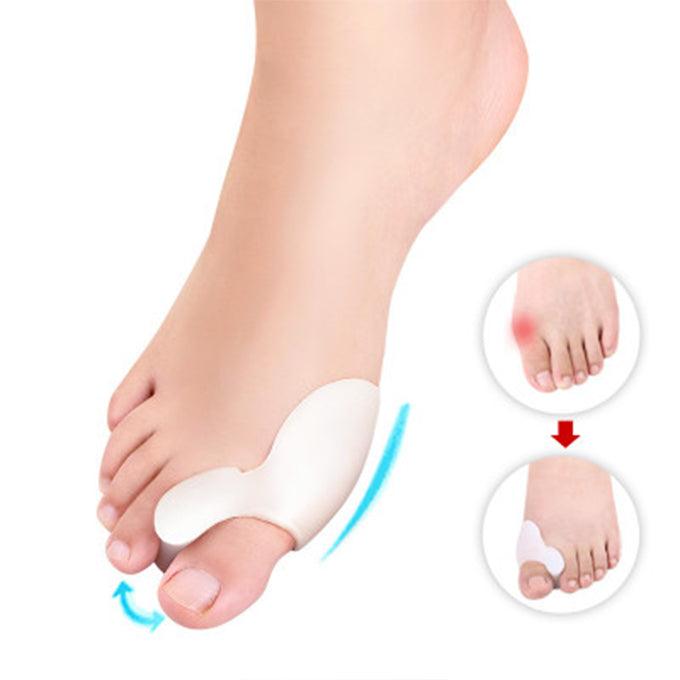 Bunion Corrector – Bunion Pain And Overlapping Toes - Custom Feet Insoles